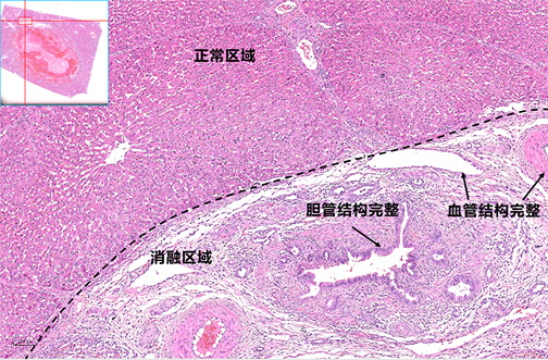 猪肝脏消融病理图