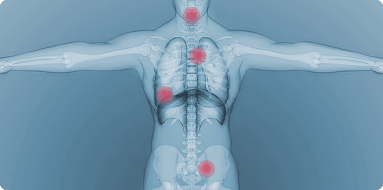 适用宽泛，突破禁区