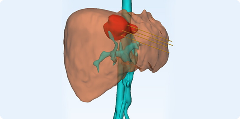 精确赋能，范围可控