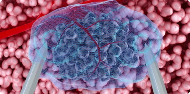 扩大范围，提高效率